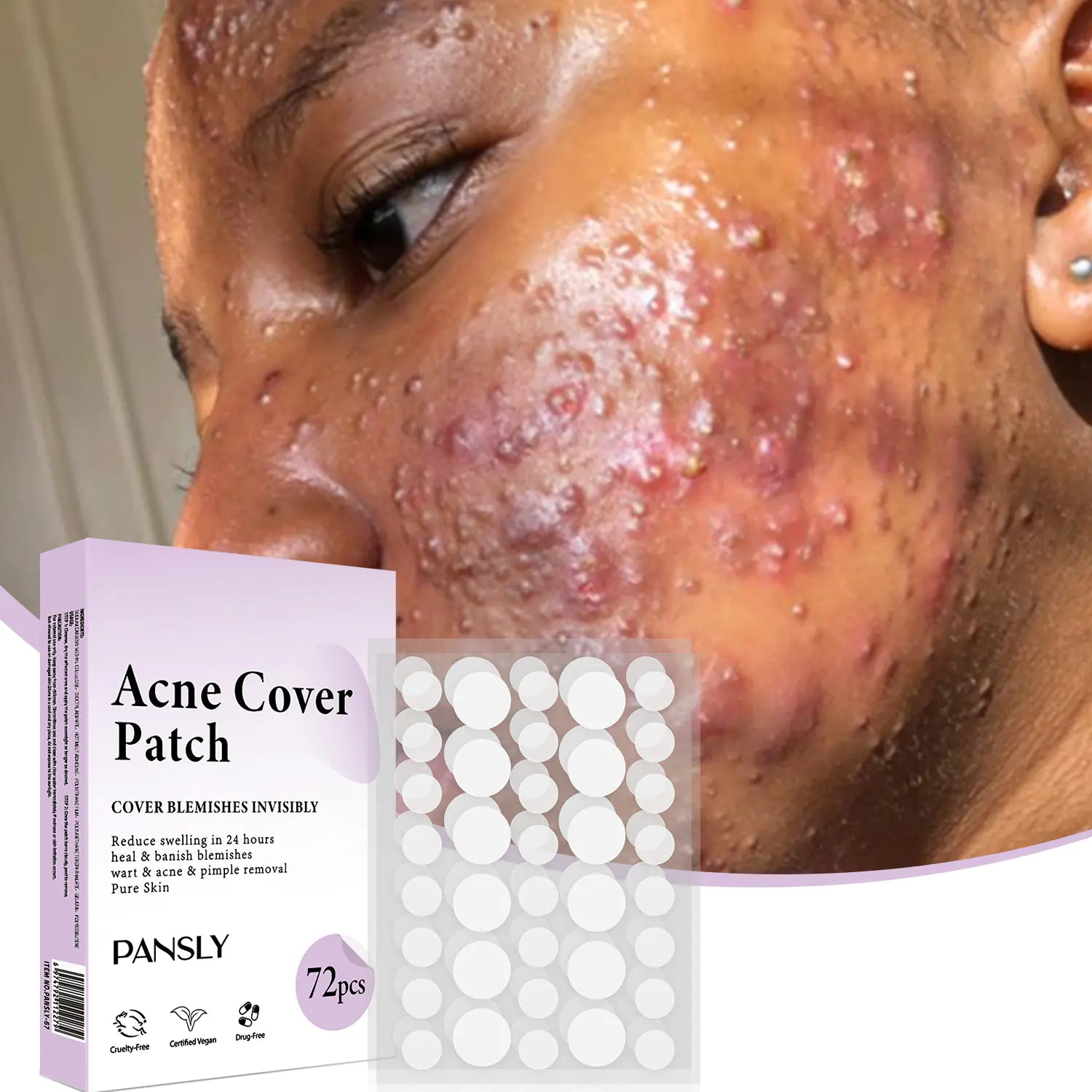 Acne Patch Skin Care - 72 Pcs